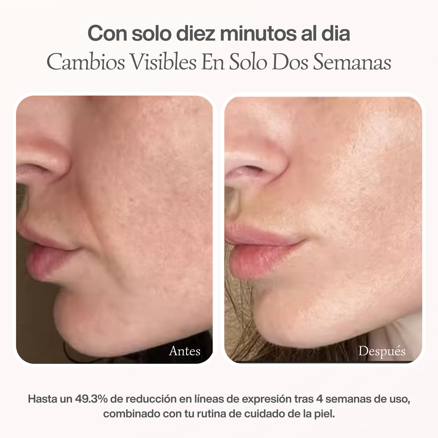 Masajeador Facial EMS de Microcorriente