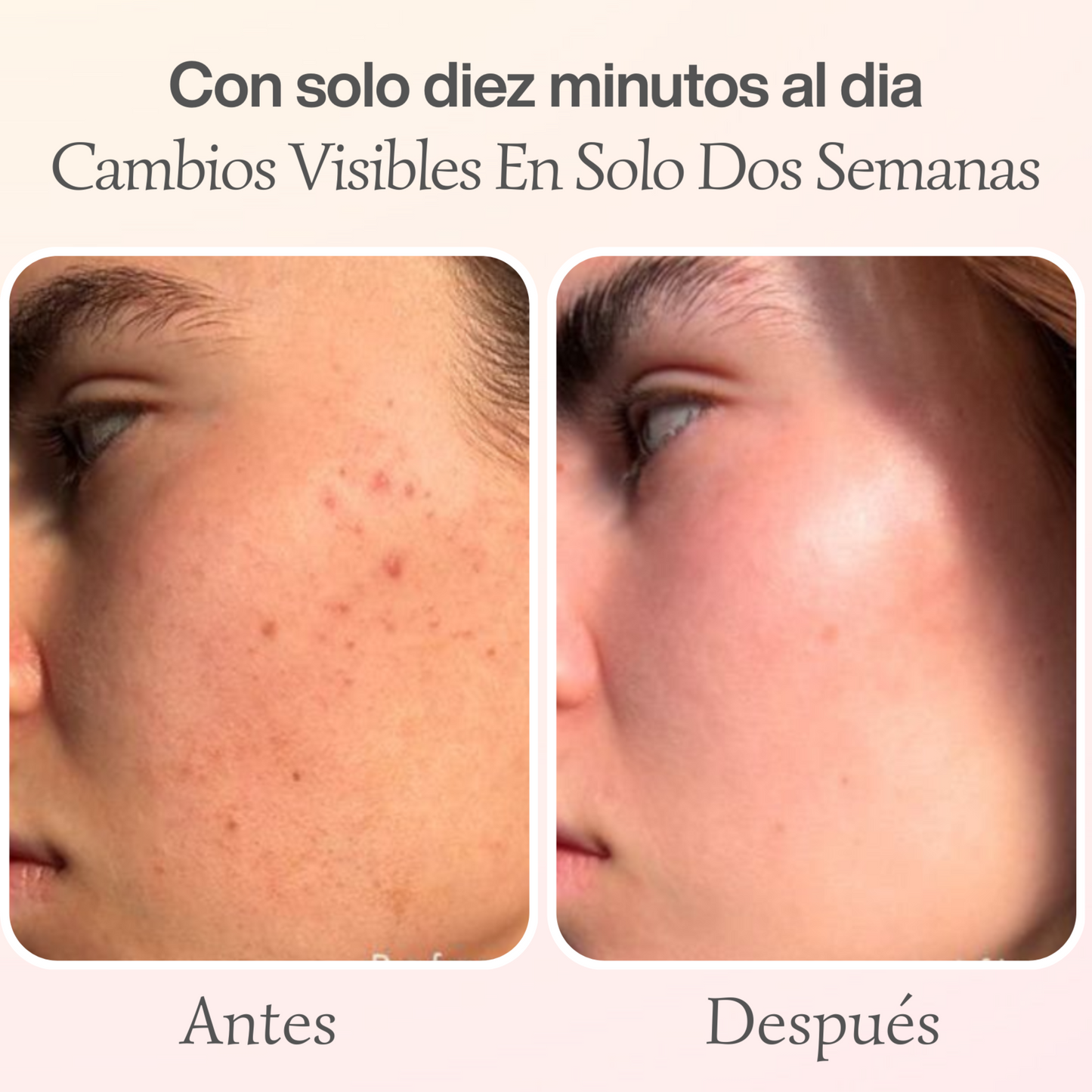 Varita Facial EMS con Luz Roja